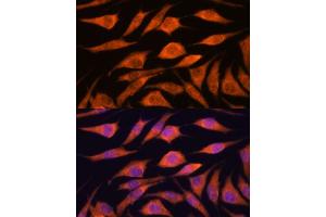 Immunofluorescence analysis of L929 cells using UPF3A antibody (ABIN7271227) at dilution of 1:100. (UPF3A antibody  (AA 327-476))