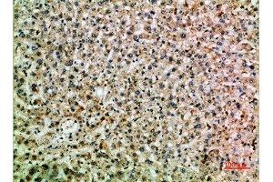 Immunohistochemistry (IHC) image for anti-TNFAIP3 Interacting Protein 2 (TNIP2) (AA 61-110) antibody (ABIN7189517)