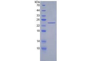 SDS-PAGE analysis of Human Acetylcholinesterase Protein.