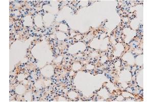 ABIN6267601 at 1/200 staining Mouse lung tissue sections by IHC-P. (NF-kB p65 antibody  (pThr435))