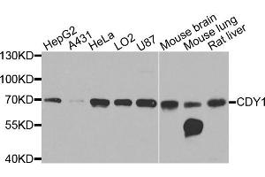 Western blot analysis of extracts of various cells, using CDY1 antibody.