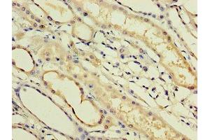 Immunohistochemistry of paraffin-embedded human kidney tissue using ABIN7156549 at dilution of 1:100 (IFNa14 antibody  (AA 24-189))