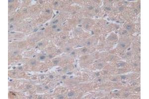 IHC-P analysis of Human Kidney Tissue, with DAB staining. (NOTCH4 antibody  (AA 1715-2001))