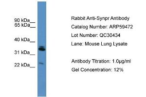 WB Suggested Anti-Synpr  Antibody Titration: 0. (Synaptoporin antibody  (Middle Region))