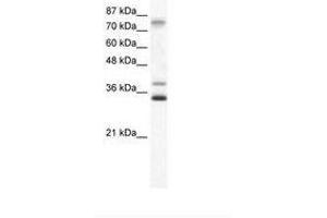 ZNF570 Antikörper  (AA 68-117)
