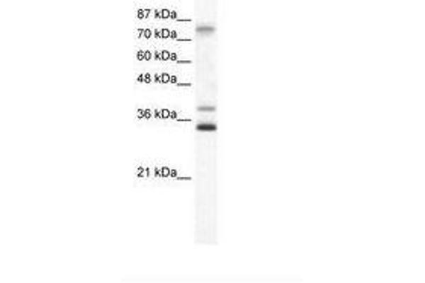 ZNF570 Antikörper  (AA 68-117)