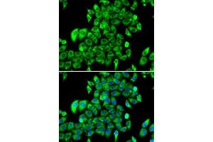 Immunofluorescence analysis of MCF-7 cells using RPL13 antibody.