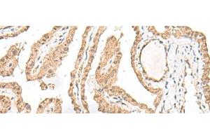 GARNL1 antibody