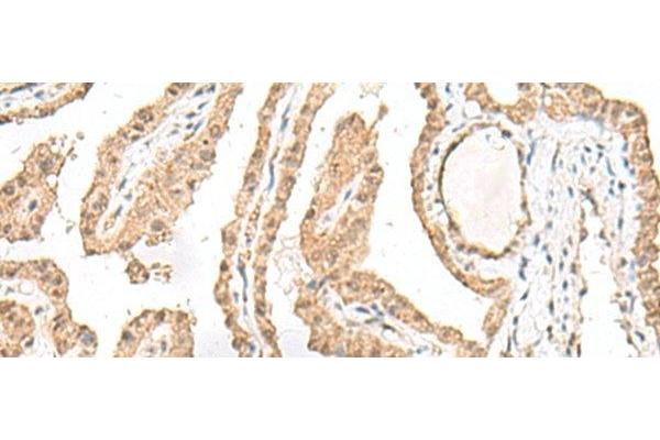 GARNL1 antibody