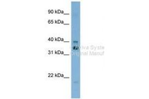Image no. 1 for anti-General Transcription Factor IIH, Polypeptide 2, 44kDa (GTF2H2) (AA 323-372) antibody (ABIN6742059) (GTF2H2 antibody  (AA 323-372))