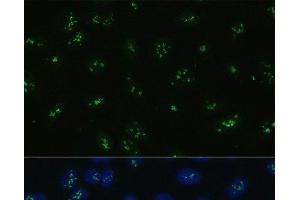 Immunofluorescence analysis of U-2 OS cells using NOLC1 Polyclonal Antibody at dilution of 1:100. (NOLC1 antibody)