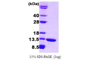 SDS-PAGE (SDS) image for Fatty Acid Binding Protein 6, Ileal (FABP6) (AA 1-128) protein (ABIN667722) (FABP6 Protein (AA 1-128))