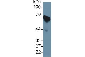 Western Blotting (WB) image for anti-Cell Division Cycle 25 Homolog B (S. Pombe) (CDC25B) (AA 377-566) antibody (ABIN1171796)