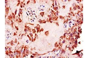 Immunohistochemistry of paraffin-embedded human placenta tissue using ABIN7156151 at dilution of 1:100 (NAALADL2 antibody  (AA 143-795))