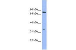 Image no. 1 for anti-Zinc Finger Protein 278 (ZNF278) (AA 35-84) antibody (ABIN6741631) (PATZ1 antibody  (AA 35-84))
