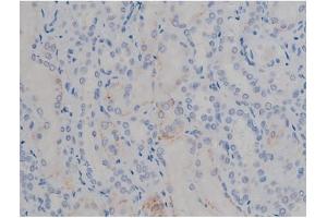 ABIN6267355 at 1/200 staining Human kidney tissue sections by IHC-P. (MAPT antibody  (pSer356))