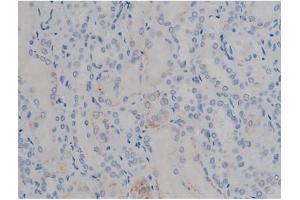 ABIN6267355 at 1/200 staining Human kidney tissue sections by IHC-P.