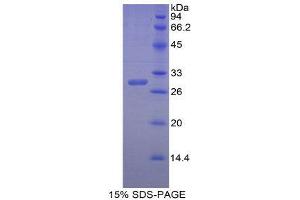SDS-PAGE (SDS) image for Carbonic Anhydrase II (CA2) (AA 5-258) protein (His tag) (ABIN1098922)