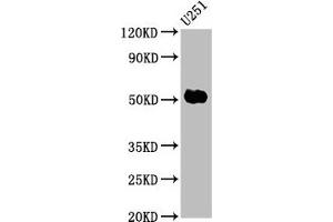 Western Blot Positive WB detected in: U251 whole cell lysate All lanes: FEZF1 antibody at 6 μg/mL Secondary Goat polyclonal to rabbit IgG at 1/50000 dilution Predicted band size: 53, 47, 52 kDa Observed band size: 53 kDa (FEZF1 antibody  (AA 1-115))