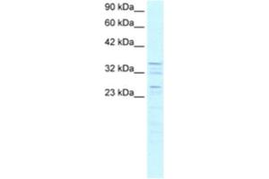 Western Blotting (WB) image for anti-Zinc Finger Protein 385A (ZNF385A) antibody (ABIN2460293) (ZNF385A antibody)