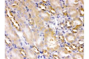 Alpha Actinin 4 was detected in paraffin-embedded sections of mouse kidney tissues using rabbit anti- Alpha Actinin 4 Antigen Affinity purified polyclonal antibody (Catalog # ) at 1 µg/mL.