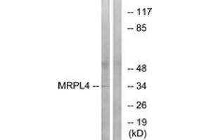 Western blot analysis of extracts from COLO cells, using MRPL4 Antibody. (MRPL4 antibody  (AA 90-139))