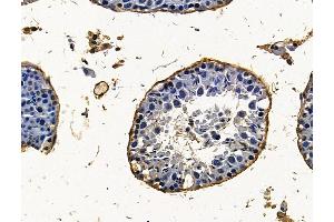 ABIN7096323 and ABIN7100385 at 1/100 staining mouse testis tissue by IHC-P. (PHF16 antibody)