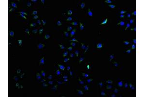 Immunofluorescence staining of HepG2 cells with ABIN7147203 at 1:50, counter-stained with DAPI.