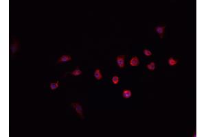 ABIN6268887 staining HeLa cells by IF/ICC.