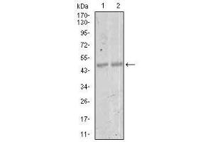 Image no. 1 for anti-Myocyte Enhancer Factor 2C (MEF2C) antibody (ABIN1490566)