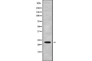 Western blot analysis of CDO1 using HeLa whole cell lysates (CDO1 antibody  (Internal Region))