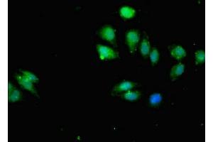 Immunofluorescent analysis of A549 cells using ABIN7156261 at dilution of 1:100 and Alexa Fluor 488-congugated AffiniPure Goat Anti-Rabbit IgG(H+L) (IKBKB antibody  (AA 395-588))
