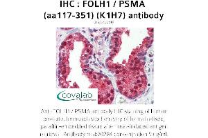 Image no. 2 for anti-Folate Hydrolase (Prostate-Specific Membrane Antigen) 1 (FOLH1) (AA 117-351) antibody (ABIN1723210) (PSMA antibody  (AA 117-351))