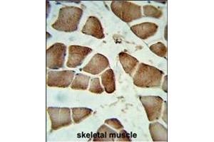 Formalin-fixed and raffin-embedded human skeletal muscle reacted with DI Antibody (Center), which was peroxidase-conjugated to the secondary antibody, followed by DAB staining. (CCDC85B antibody  (AA 69-96))