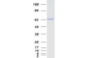 Validation with Western Blot (CTNNBL1 Protein (Myc-DYKDDDDK Tag))