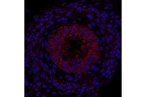 Immunofluorescence (Paraffin-embedded Sections) (IF (p)) image for anti-Sonic Hedgehog (SHH) (AA 21-120) antibody (ABIN731108)