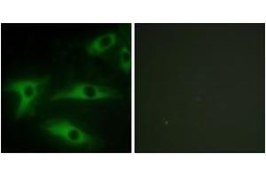 Immunofluorescence analysis of HeLa cells, using Collagen I alpha2 Antibody. (COL1A2 antibody  (AA 471-520))