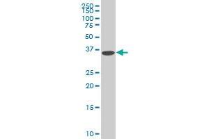 Western Blotting (WB) image for anti-Decapping Enzyme, Scavenger (DCPS) (AA 1-338) antibody (ABIN599227) (DCPS antibody  (AA 1-338))