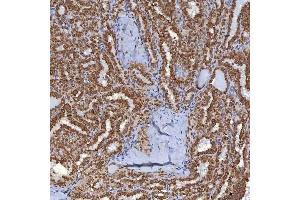 IHC analysis of TRMT61A using anti-TRMT61A antibody (ABIN7599220). (TRMT61A antibody  (AA 1-289))