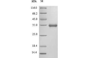 (Tris-Glycine gel) Discontinuous SDS-PAGE (reduced) with 5 % enrichment gel and 15 % separation gel. (SARS-CoV-2 Spike S1 Protein (RBD) (His tag,MYC tag))