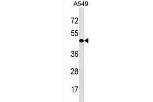 CDY1 antibody  (N-Term)