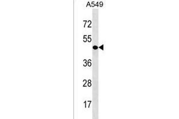 CDY1 antibody  (N-Term)