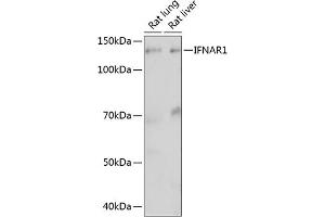 Western blot analysis of extracts of various cell lines, using IFN Rabbit mAb (ABIN1682980, ABIN3015227, ABIN3015228 and ABIN7101324) at 1:1000 dilution.