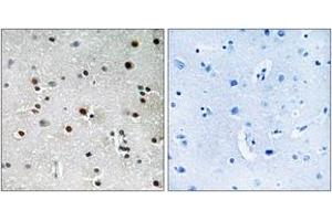 Immunohistochemistry analysis of paraffin-embedded human brain tissue, using RFX3 Antibody.