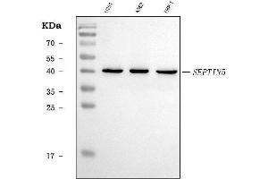 Western blot analysis of SEPT5/SEPTIN5 using anti-SEPT5/SEPTIN5 antibody (ABIN7602924).