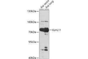 Western blot analysis of extracts of various cell lines, using KLHL11 antibody (ABIN7268078) at 1:1000 dilution. (KLHL11 antibody  (AA 16-300))