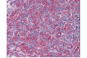 Image no. 1 for anti-Frizzled Family Receptor 7 (FZD7) (C-Term) antibody (ABIN374921) (FZD7 antibody  (C-Term))