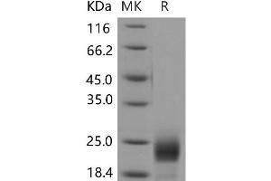 Western Blotting (WB) image for CD302 (CD302) protein (His tag) (ABIN7320181) (DCL1 Protein (His tag))