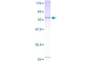 NCEH1 Protein (AA 1-408) (GST tag)