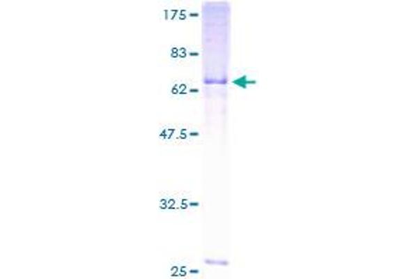NCEH1 Protein (AA 1-408) (GST tag)